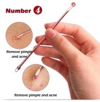 Lanbena Инструменты для чистки лица набор 4шт Acne Blackhead Removal Tool Set